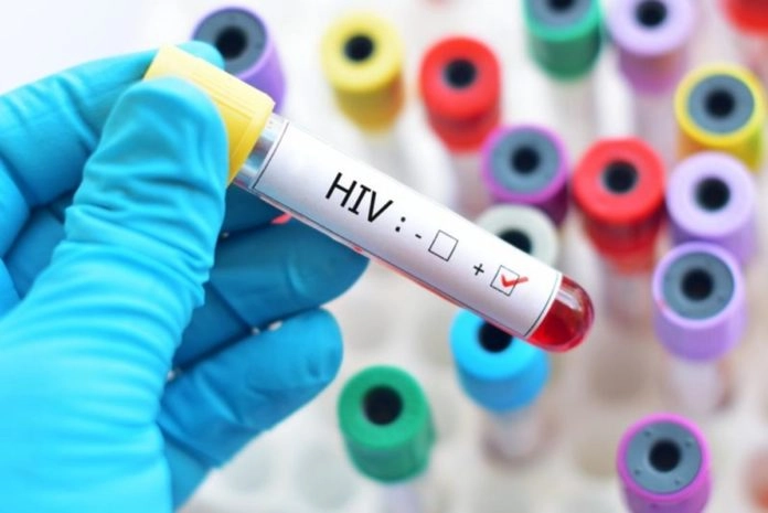 Pela primeira vez na história, mais de metade das pessoas com HIV terá acima de 50 anos