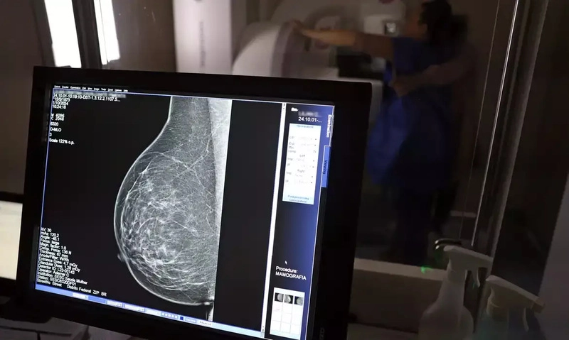 Planos de saúde terão que cobrir mamografia digital sem limite de idade