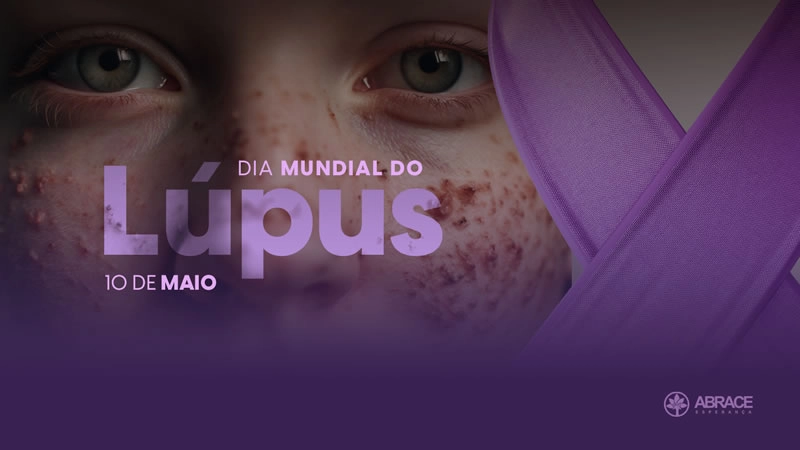 Imagem de exemplo