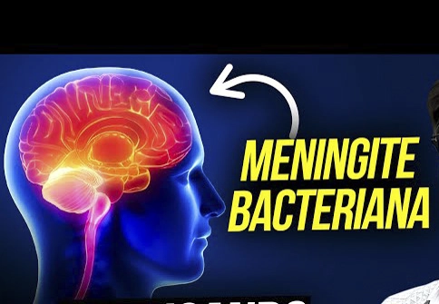 MENINGITE BACTERIANA: Exame auxilia diagnóstico da doença na rede pública do GDF