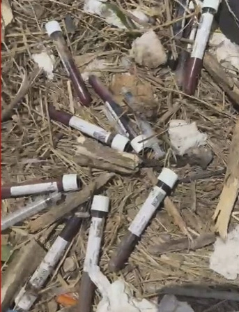 RISCO BIOLÓGICO: Seringas e tubos de sangue descartados de forma irregular  em Taguatinga