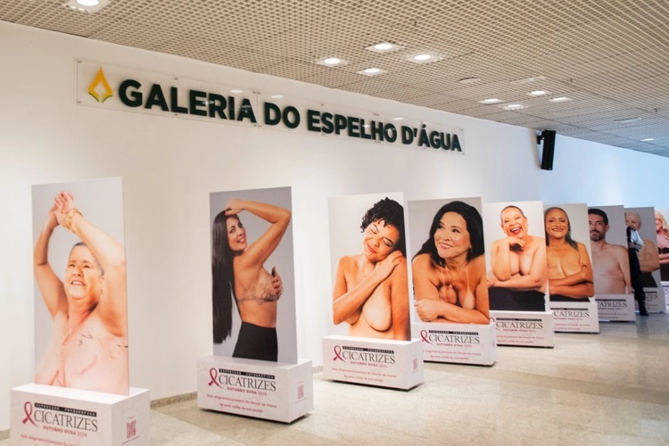 CÂNCER DE MAMA: Câmara Distrital apresenta exposição fotográfica “Cicatrizes”, que alerta sobre a doença