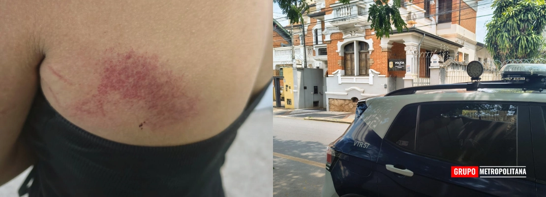 MULHER ESCAPA DE AGRESSÕES APÓS JOGAR ÁGUA QUENTE NO COMPANHEIRO; HOMEM É PRESO EM PIRACICABA